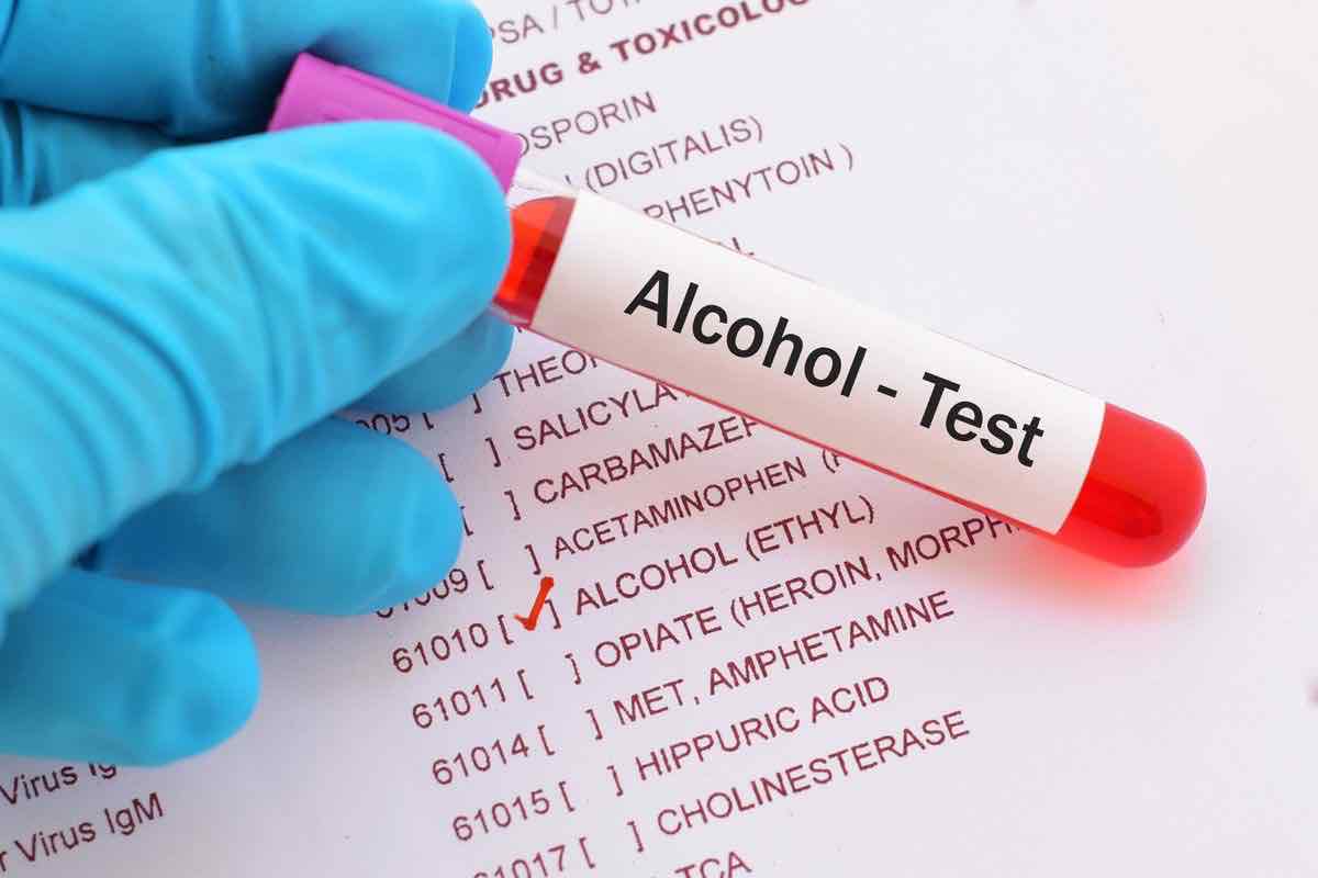 Alcolici Alcool test dati
