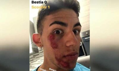 bastianini incidente scooter