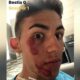 bastianini incidente scooter